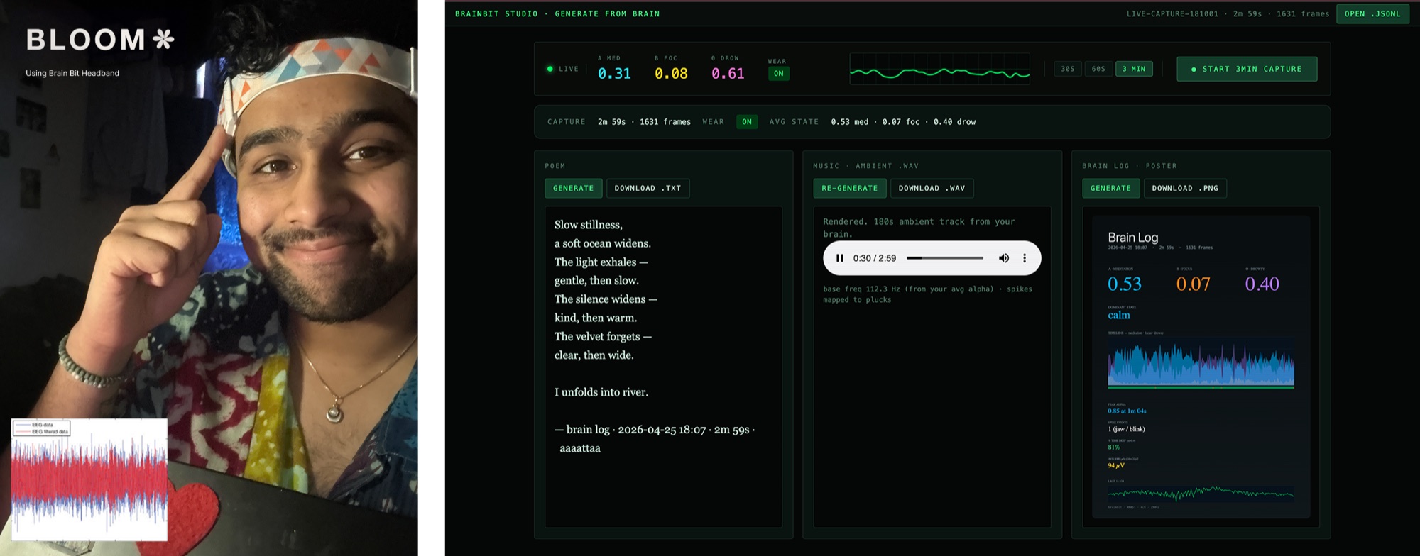 The Bloom operator view, with live audio levels and the session log